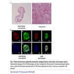 Establishment of patient-derived tumor spheroids for non-small cell lung cancer