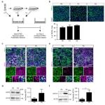 A novel method for expansion and diferentiation of mouse tracheal epithelial cells in culture